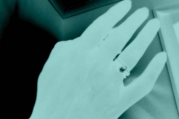 Office Mum - broken finger